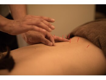 オベロン 銀座(Oberon)/鍼灸施術