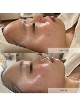 ウルス(ulus)/アンストレス