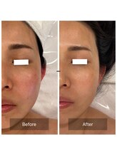 マインエム(mine.m)/敏感肌SEN管理