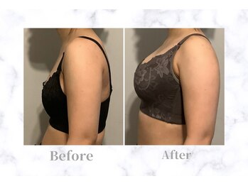 ふじこのきもち/24回コース×2回終了　20代