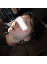 あいこ鍼灸院/天使の100本美容鍼