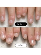 スマイルニコ(smile nico)/