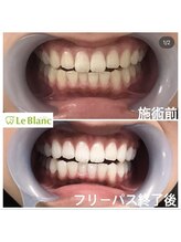 ルブラン 奈良店(Le Blanc)/忙しい方にこそおすすめ