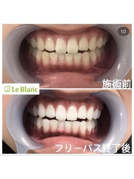 ルブラン 奈良店(Le Blanc)/忙しい方にこそおすすめ