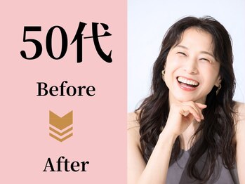 アメリイ 百合ヶ丘 新百合ヶ丘(Amerii)/【50代】ダイエット痩身の実績