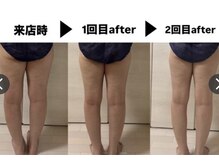 ヨサパーク メンソーレ(YOSA PARK)/代謝アップで体が変わる
