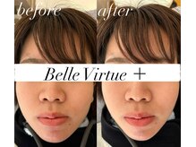 ベルバーチュプラス(Belle Virtue +)/インナーインパクト