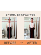 リップル オステオパシー整体院(RIPPLE)/姿勢の変化5