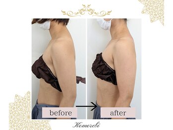 コモレビ(Komorebi)/