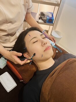 ハリファ鍼灸院 熊本院(HariFa鍼灸院)/美容鍼