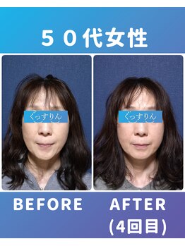 ぐっすりん/複数回継続のお客様の変化(6)