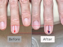 ヨナ バイ ソレカ(YONA bySORECA)/本格自爪育成【ジェルなし】