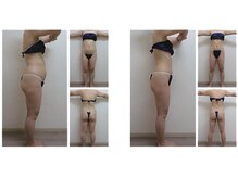 ミネルバエンダモロジー/エンダモロジー/痩身/ウェルネス