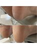 【これで完璧♪】つるふわ足裏角質ケア