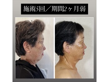 真美(Sinbi)/「美しさは自信から始まる」