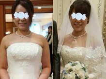 小顔コースで来店。首の位置も変わりお顔のむくみ解消！小顔に！