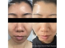 エンビロンサロン エイジングルーム ラヴィーア(Lavia)の雰囲気（お肌悩みに根本改善[エンビロン/フェイシャル/ニキビケア] ）