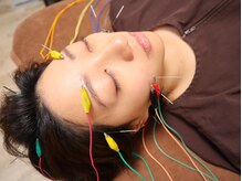 美容鍼で本来の美しさを、鍼で引き出し、深く眠れる美容鍼。