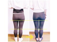 ポノフィット(PONO FIT.)/症例／ヒップ