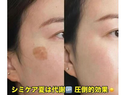 東洋経絡エステ アンド リラクゼーションの写真