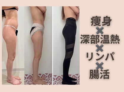 ミリ(MiLi)の写真