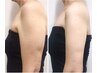 ★プルプルタイプ・がっしりタイプもカバー★二の腕120分 ¥11980