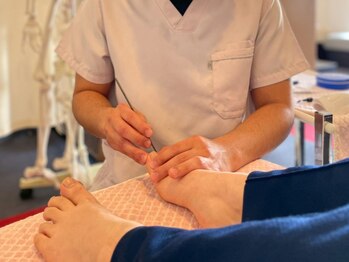 ほりうち鍼灸整骨院の写真/巻き爪でお悩みの方に◎穴を開けない！爪を抜かない！国家資格所持者のみ施術可能なワイヤー矯正★