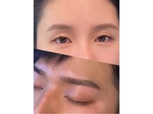 ナチュベル(Natubelle)