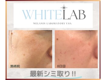 エスポワールカルド(Espoir caldo)