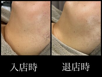 ビーエルティー(blt)/レモンボトル