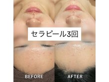 ヴィヴ 三島店(Vive)/《セラピール》