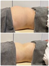 整体院トゥルース/たるんだお腹がスッキリ！