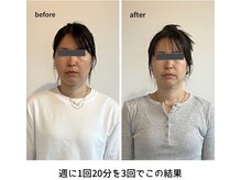 ソルズ(sol'z)の雰囲気(小顔矯正/エラ剥がし/食いしばり/たるみ)