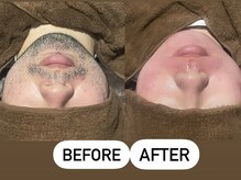 ソーレエルーナ(SOLE e LUNA)/メンズ 新宿 脱毛専門 ワックス