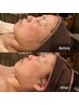 艶肌リフトアップ　光フェイシャル