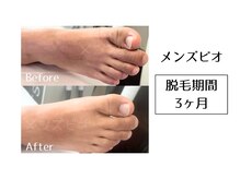 メンズビオ 神戸三宮店/