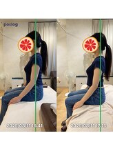 グレフル鍼灸接骨院 整体院 心斎橋/整体/肩こり/マッサージ/腰痛