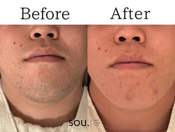 ソウ 津幡店(sou.)/