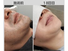 イマサカスの雰囲気（丁寧かつ、スピーディーな施術でご案内しております♪）