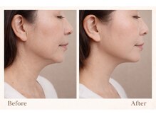 クラルスシンメトリーサロン 高槻店(Clarus Symmetry Salon)/