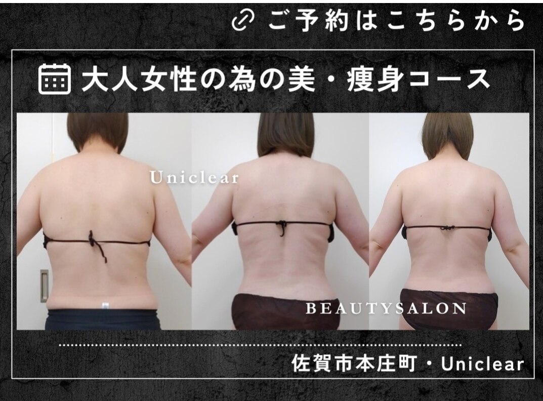 ユニクリア 佐賀(Uniclear)｜ホットペッパービューティー