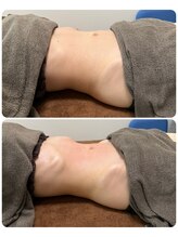 グレースヒーリング(GRACE HEALING)/本日の腸もみ