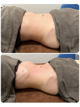 グレースヒーリング(GRACE HEALING)/本日の腸もみ