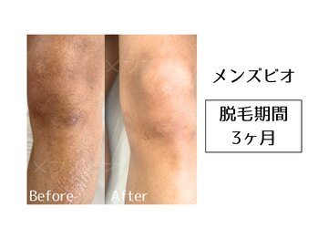 メンズビオ 神戸三宮店/