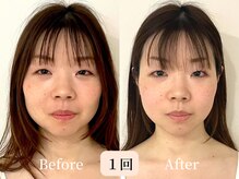 ロシュニ/30代 お悩み:歪み/偏頭痛/肩こり