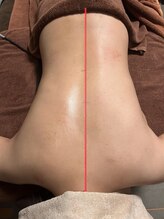 シェノンミュリール(Chainon Murir)/施術変化　ボディ