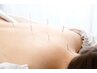 【オープン記念50％オフ】全身オーダーメイド鍼灸施術(70分)¥11550→¥5775