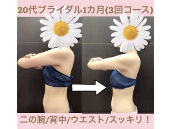 スワン 新栄店(SWAN)/20代ブライダル1カ月(3回コース)