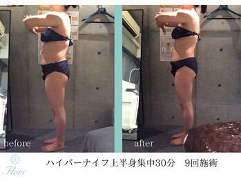 フローレ 豊田店(Flore)/確実な結果でサイズダウン