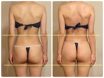 トータルボディセラピーハート(Heart)/ヒップUP美尻も叶うバストケア